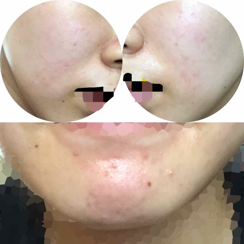 明色美顔水 薬用化粧水/美顔/化粧水を使ったクチコミ(3枚目)