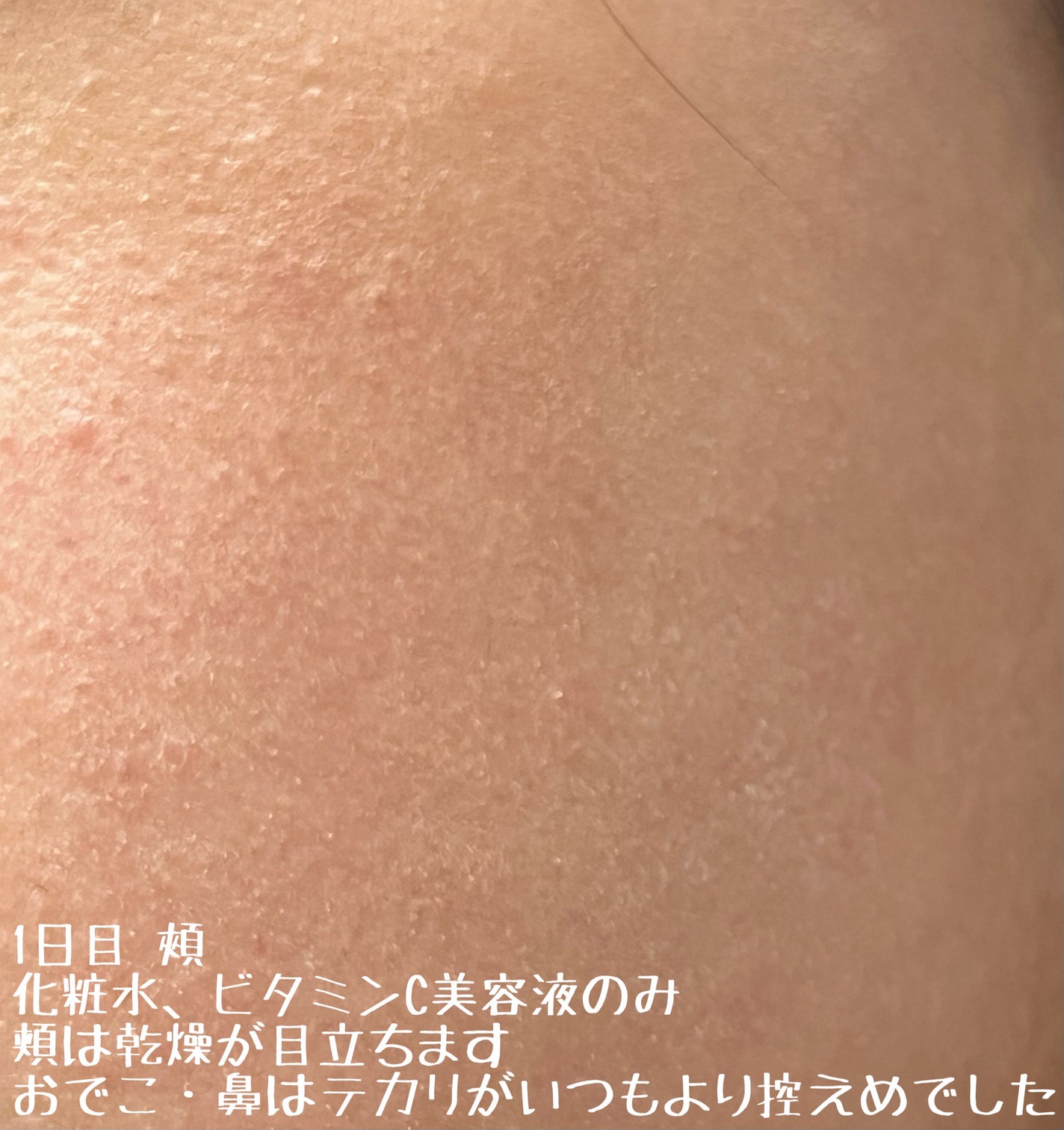 カラミー カラミンノーセバムジェル/Calamee/フェイスクリームを使ったクチコミ(5枚目)