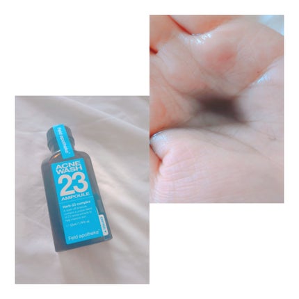 アクネウォッシュ23アンプル/Feld Apotheke/美容液を使ったクチコミ(1枚目)