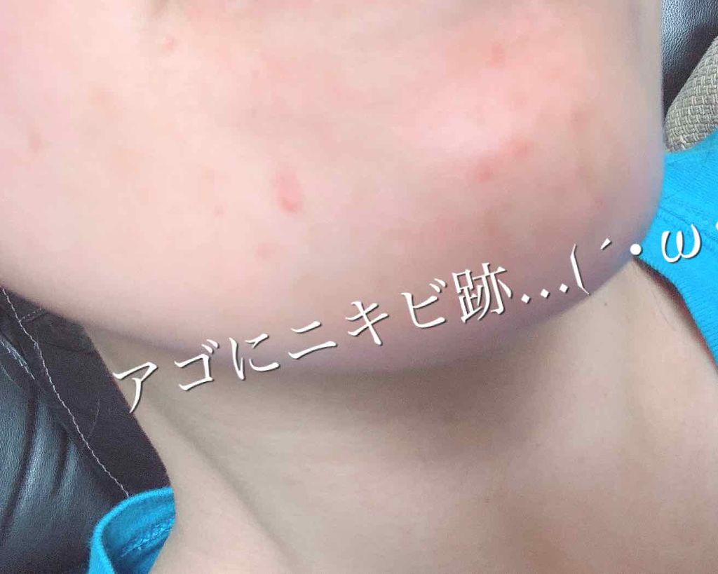 モイスチャークリーム4|エンビロンを使った口コミ 「 混合肌(※冬場は ...