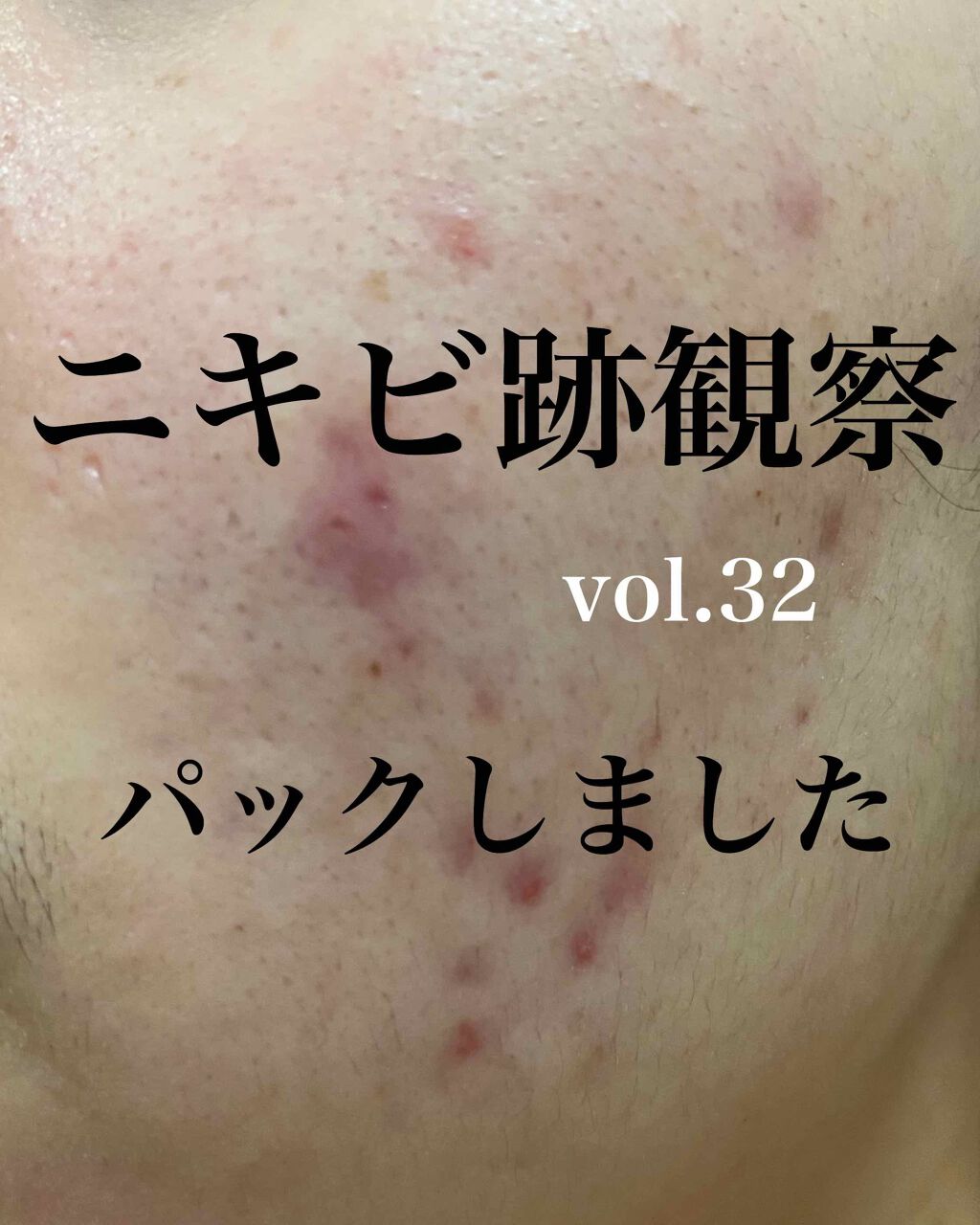 プレミアムフェイスマスクPT/マイオーガニー/シートマスク・パックを使ったクチコミ（1枚目）