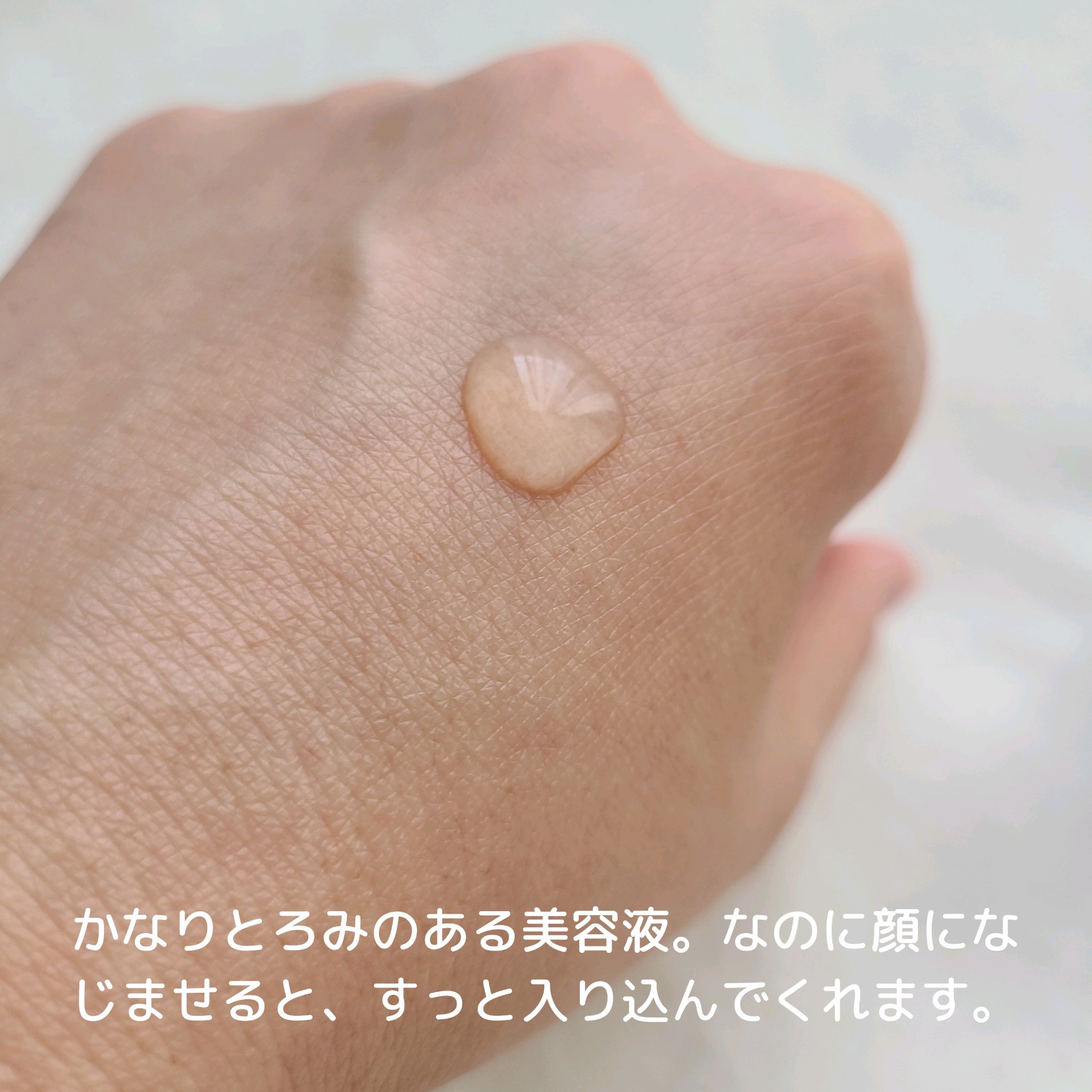 エファクラ ピールケア セラム/ラ ロッシュ ポゼ/美容液を使ったクチコミ（3枚目）