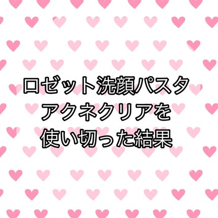ロゼット洗顔パスタ アクネクリア/ロゼット/洗顔フォームを使ったクチコミ(1枚目)