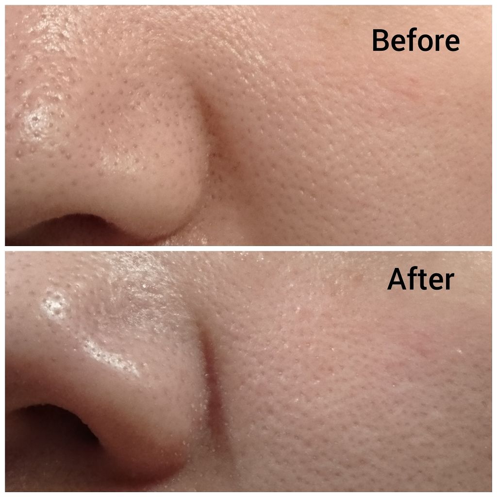 CARE-NA*ホットクールジェル/オルビス/洗い流すパック・マスクを使ったクチコミ(3枚目)