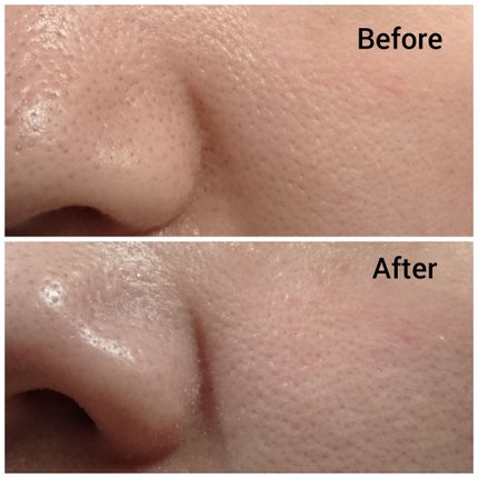 CARE-NA*ホットクールジェル/オルビス/洗い流すパック・マスクを使ったクチコミ(3枚目)