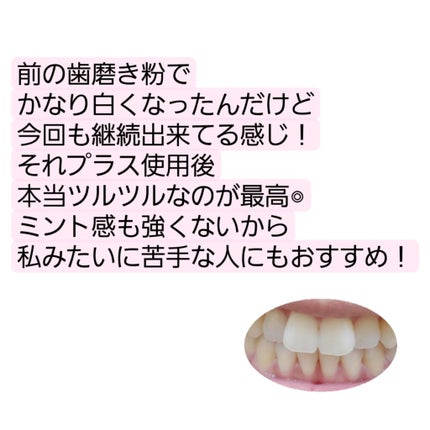 アパガードプレミオ/アパガード/歯磨き粉を使ったクチコミ(5枚目)