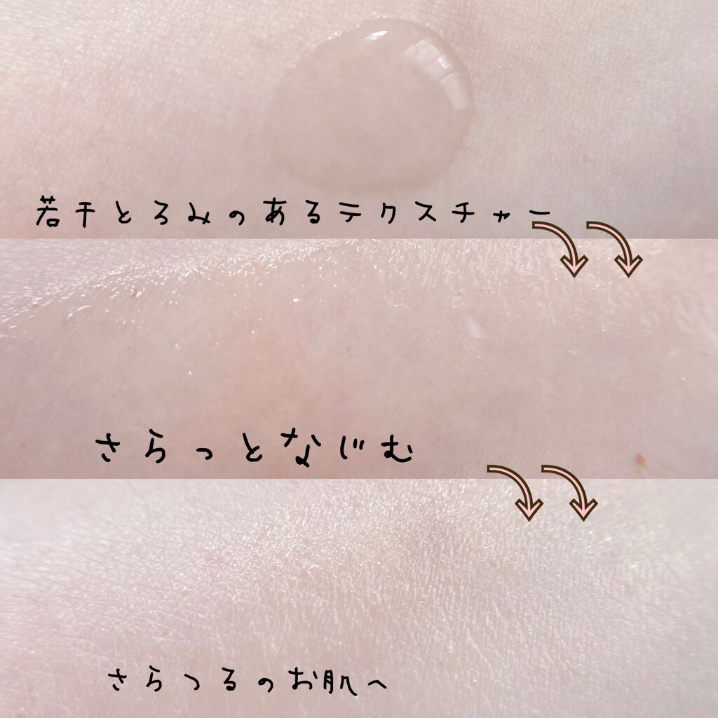 スーパー毛穴ピールセラム スーパー毛穴ピールセラム5　30ｍL（約1か月分）/ラボラボ/美容液を使ったクチコミ（3枚目）