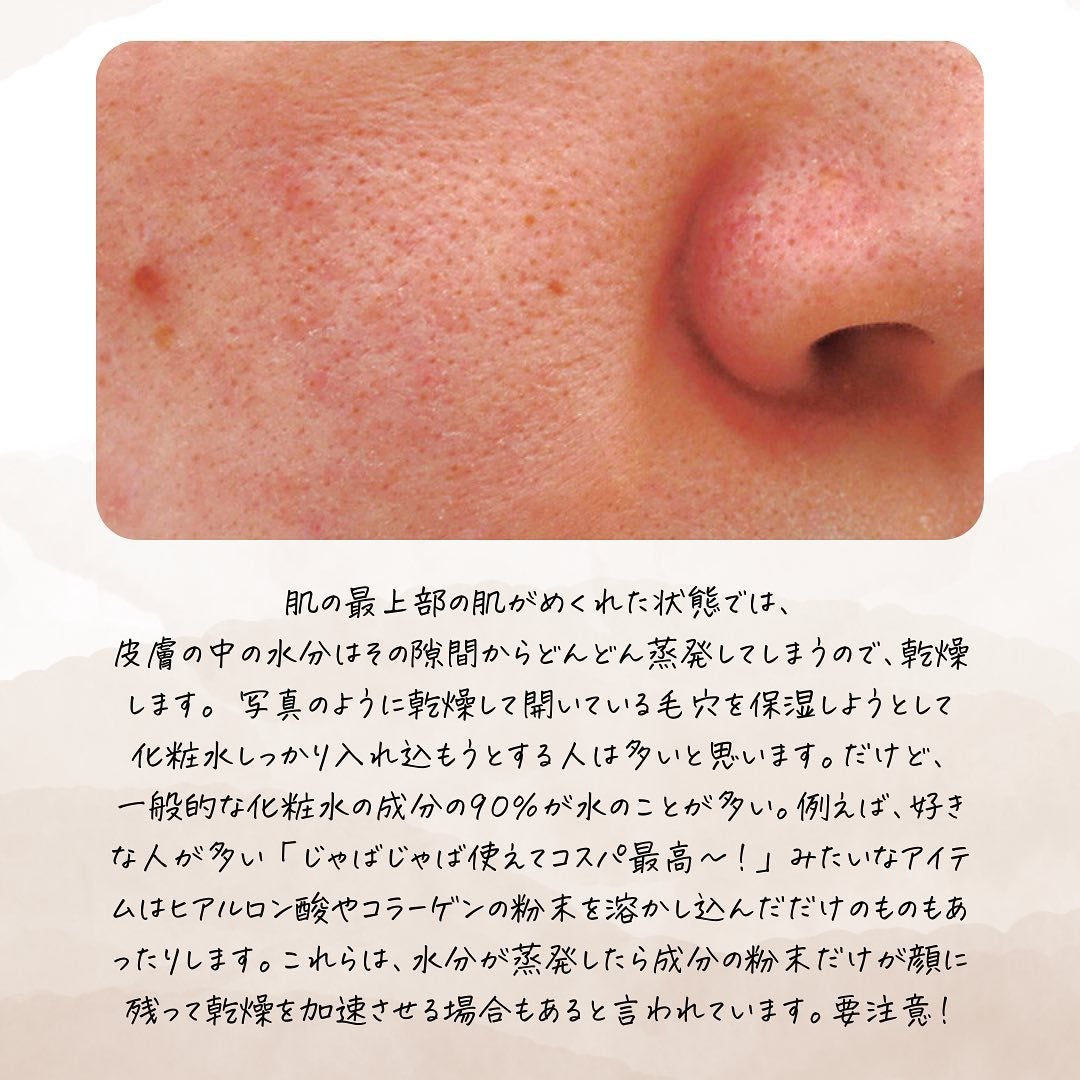 おゆみ|ニキビ・ニキビ跡ケア on LIPS 「@______ohyoume他の投稿はこちら✊✨【お風呂入って..」(6枚目)