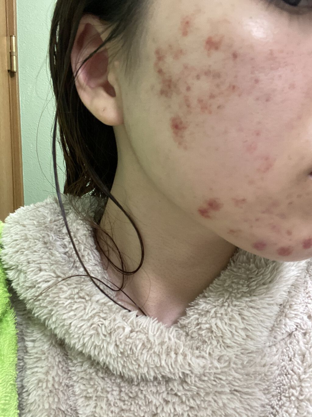 N.M.FアクアアンプルマスクJEX/MEDIHEAL/シートマスク・パックを使ったクチコミ（2枚目）