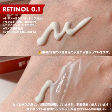 Frankly レチノール0.1％クリームのクチコミ「

【FRANKLY】


RETINOL 0.1
#シワ改善レチノールクリーム
#複合シワ改.....」（2枚目）