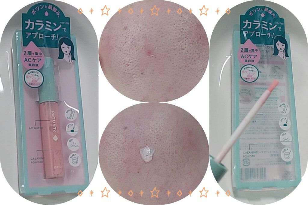 スポットパウダーエッセンス/ポツント/美容液を使ったクチコミ（2枚目）