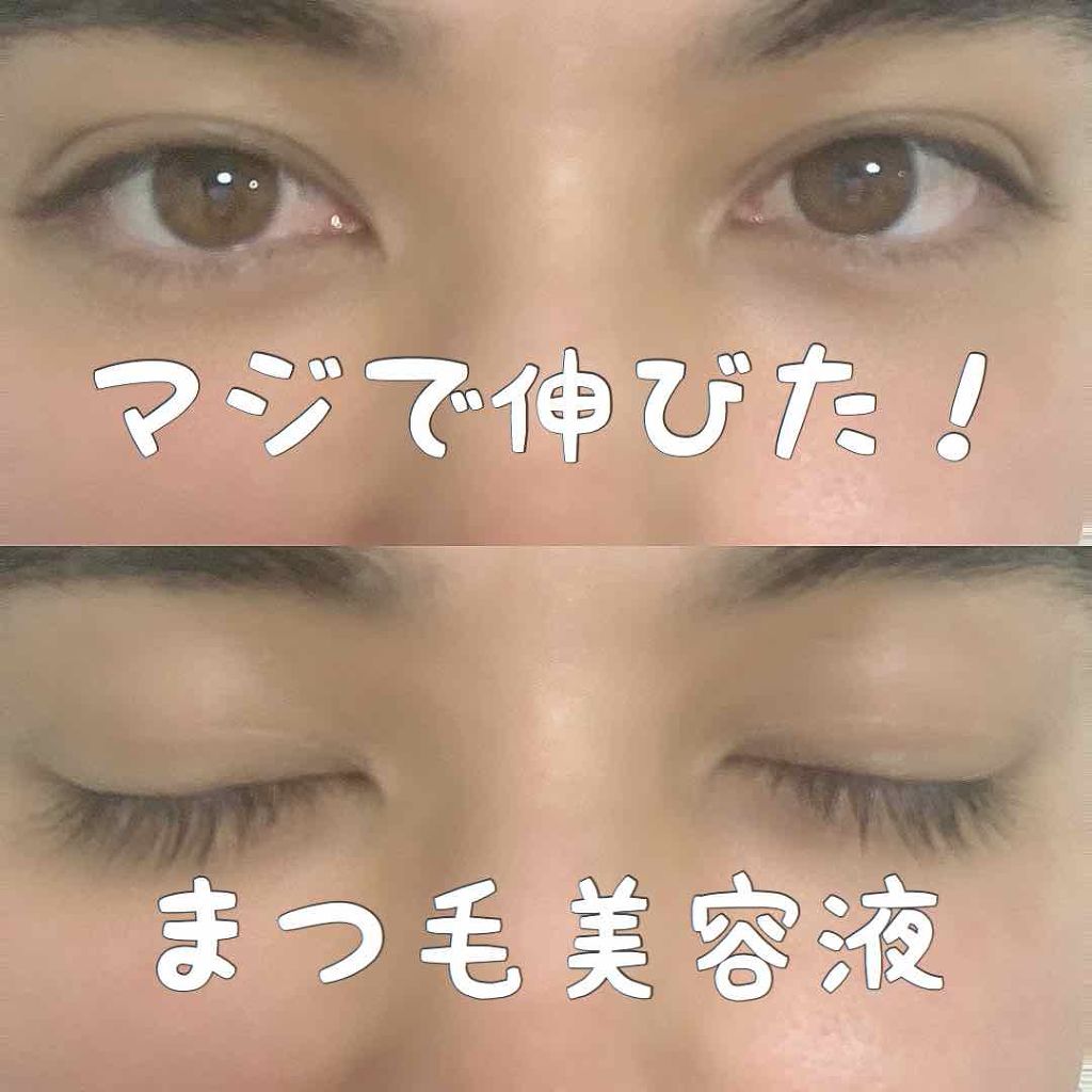 グロウアイラッシュセラム/フェース/まつげ美容液を使ったクチコミ（1枚目）