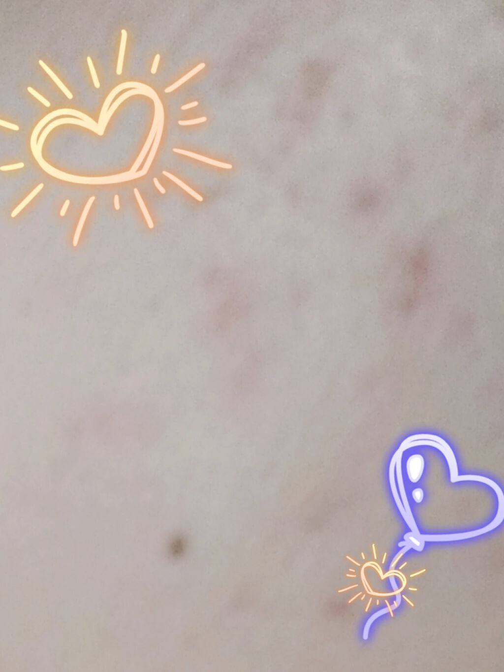 極潤 ヒアルロン液(旧)/肌ラボ/化粧水を使ったクチコミ（3枚目）