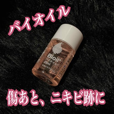 
皆さま、こんばんは(♡)なつみかん🍊です✨✨


小林製薬 バイオイル 25ml ￥700(税抜)


バイオイルは1987年に南アフリカ共和国で
発売され現在は世界142カ国で販売されている
グロー