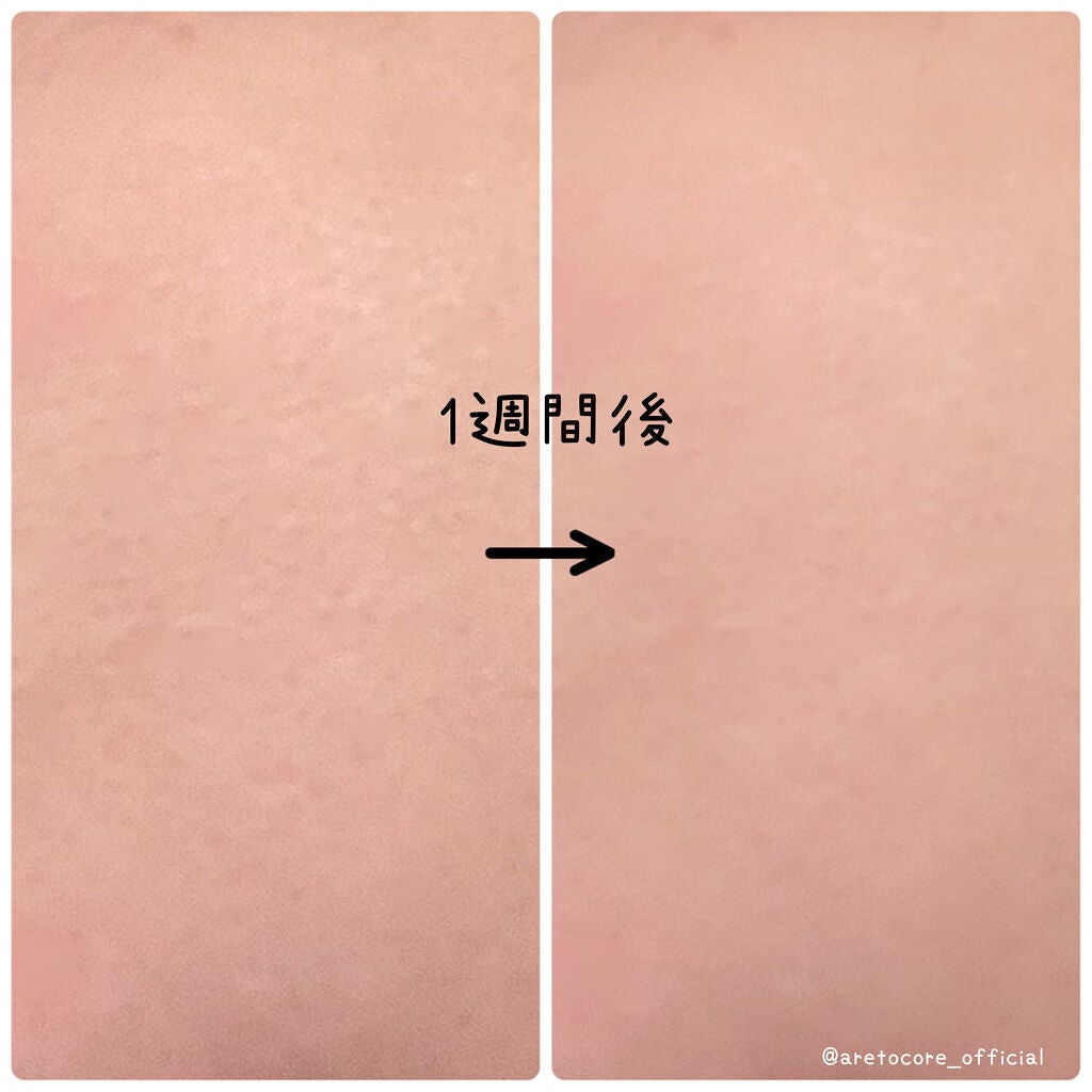 ビタドリップセラム /KarteMade /美容液を使ったクチコミ(3枚目)