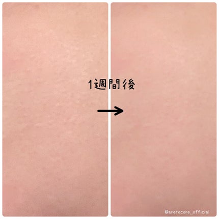 ビタドリップセラム /KarteMade /美容液を使ったクチコミ(3枚目)