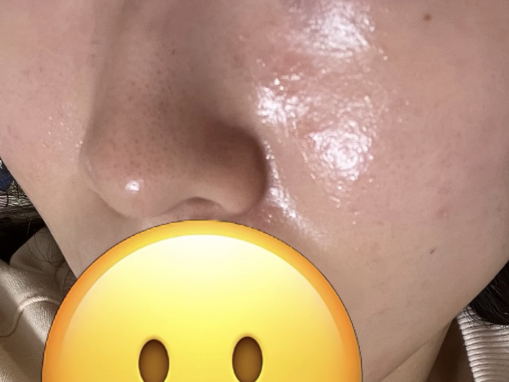 レチビタエッセンスマスク/ピュレア/シートマスク・パックを使ったクチコミ（2枚目）