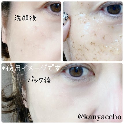 リアルシカペストパック/ビューランチ/洗い流すパック・マスクを使ったクチコミ(3枚目)