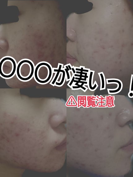 白色ワセリン(医薬品)/健栄製薬/その他を使ったクチコミ(1枚目)