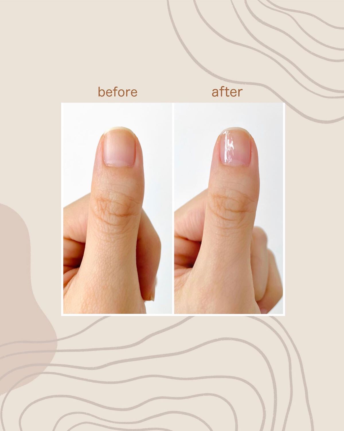 グロスフォーユアネイル/プレビュート/オールインワンネイルを使ったクチコミ(3枚目)