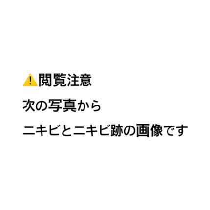 メラノCC 薬用しみ集中対策液(旧)/メラノCC/美容液を使ったクチコミ(1枚目)