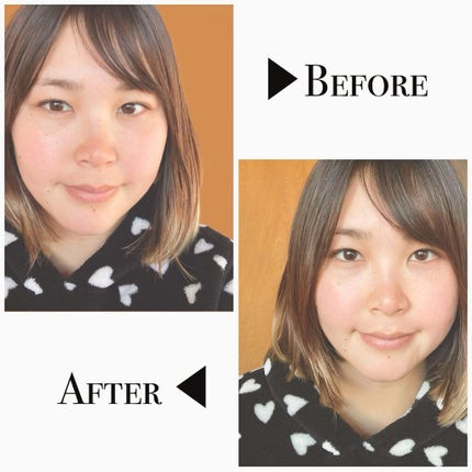 PLUMINUS/mous./美顔器・マッサージを使ったクチコミ(6枚目)