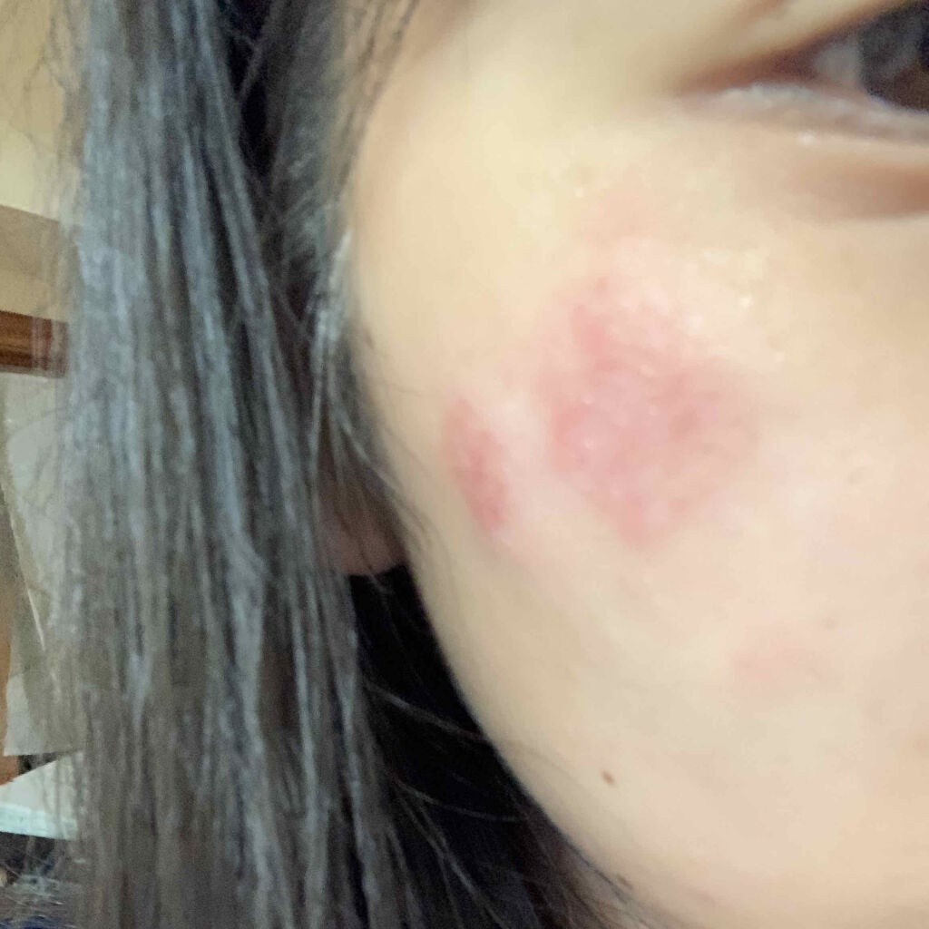 ハトムギ化粧水(ナチュリエ スキンコンディショナー R )/ナチュリエ/化粧水を使ったクチコミ(2枚目)