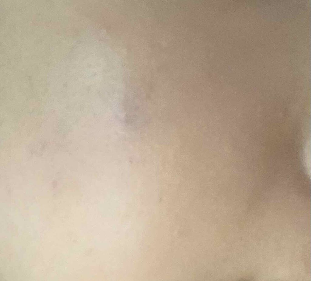 【旧】ディオールスキン フォーエヴァー スキン コレクト コンシーラー/Dior/リキッドコンシーラーを使ったクチコミ（3枚目）