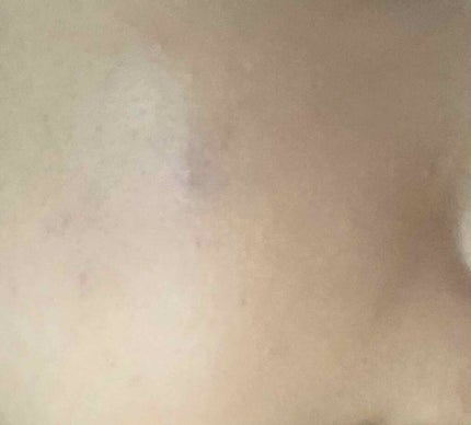 【旧】ディオールスキン フォーエヴァー スキン コレクト コンシーラー/Dior/リキッドコンシーラーを使ったクチコミ(3枚目)