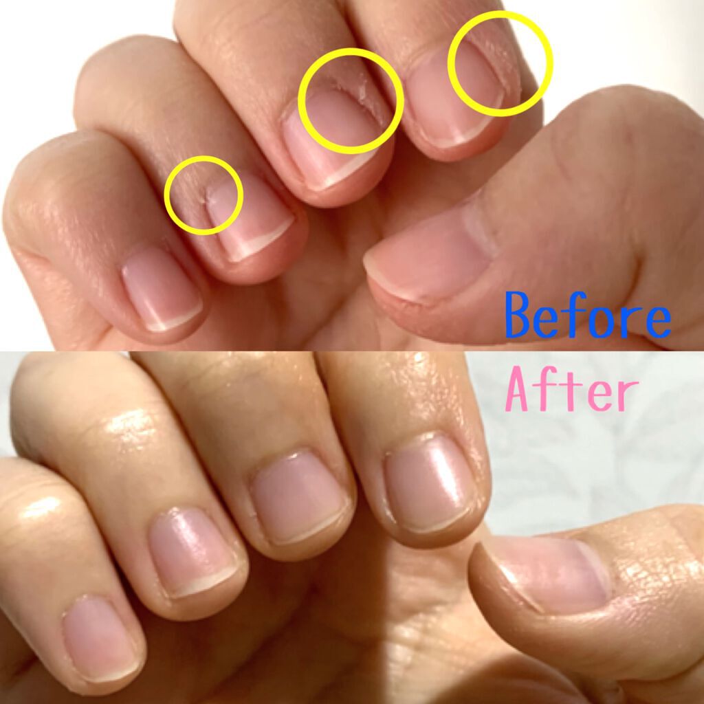 ナイトリニューハンドクリーム/コエンリッチQ10/ハンドクリームを使ったクチコミ(4枚目)