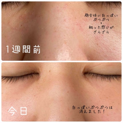 チョコラBBスパークリング/チョコラBB/美容ドリンクを使ったクチコミ(4枚目)