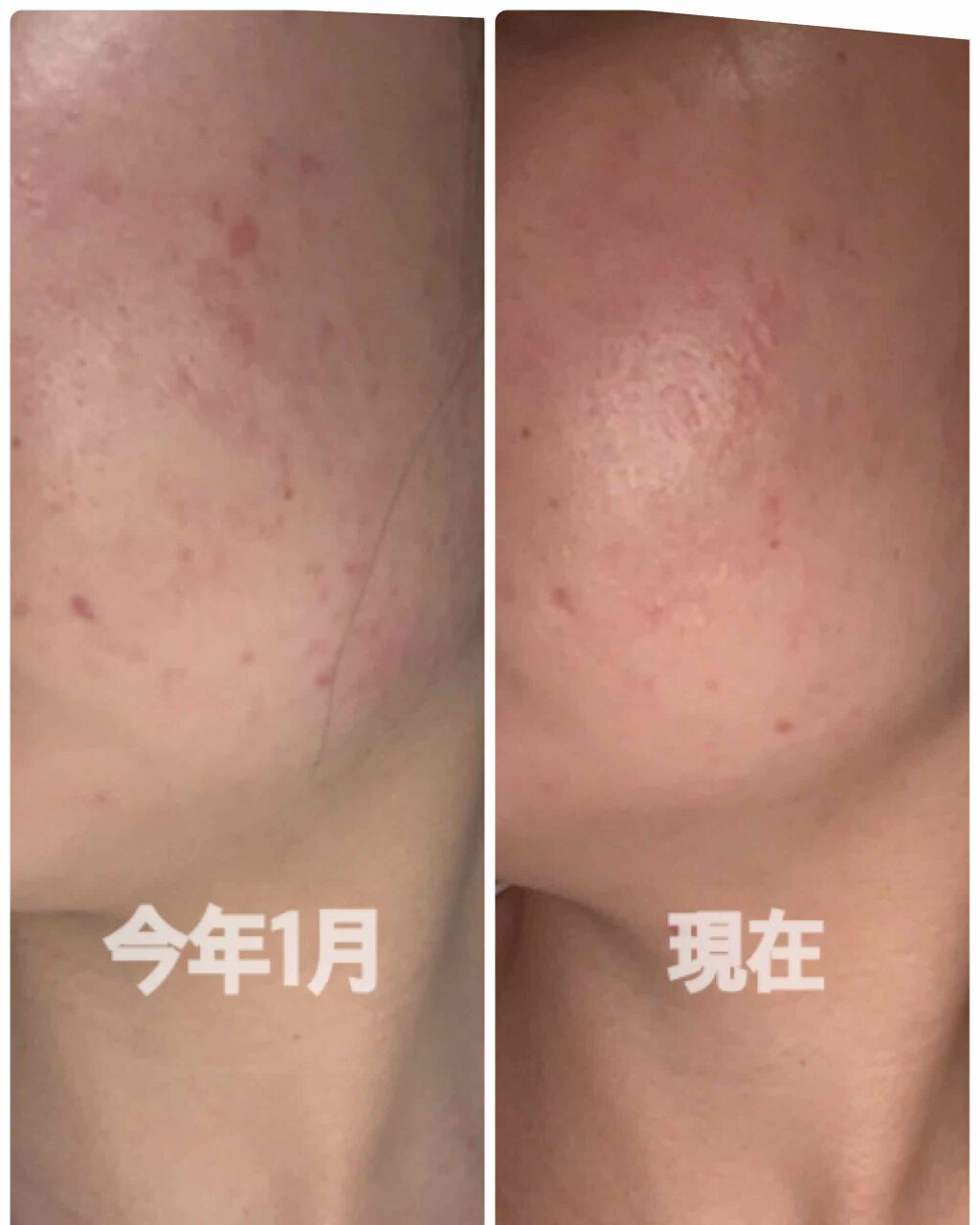 フィトチューン ハイドロ チューナー/DECORTÉ/化粧水を使ったクチコミ(2枚目)