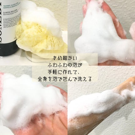 AHA·BHA·PHA 30デイズミラクルアクネボディクレンザー/SOME BY MI/ボディソープを使ったクチコミ(4枚目)