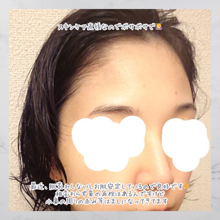 ã°ãªãŒã³ã¿ã³ãžã§ãªã³ ãã¿C ããŒã¯ã¹ãããã±ã¢ã»ã©ã /goodal/çŸå®¹æ¶²ã䜿ã£ãã¯ãã³ãïŒ4æç®ïŒ