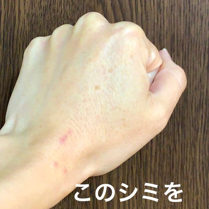 ぽち on LIPS 「六角館さくら堂@sakurado.kyotoしみ・クマ消しコン..」(6枚目)