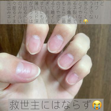 ディープセラム Dr Nailの辛口レビュー Dr Nailディープセラム出産を控えて By にゃんぴ 乾燥肌 Lips