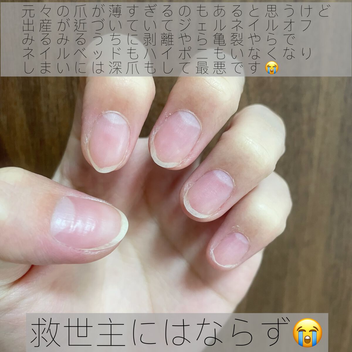 ディープセラム/Dr.Nail/ネイルオイル・トリートメントを使ったクチコミ(2枚目)