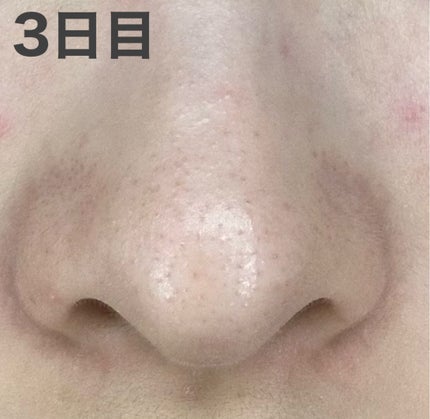 ロゼット洗顔パスタ ブラックパール/ロゼット/洗顔フォームを使ったクチコミ(2枚目)