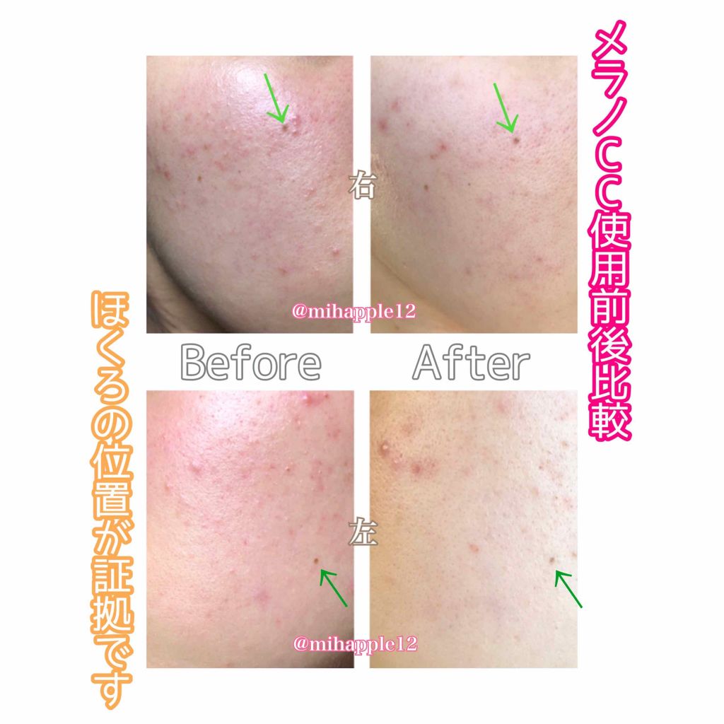 明色美顔水 薬用化粧水/美顔/化粧水を使ったクチコミ（3枚目）