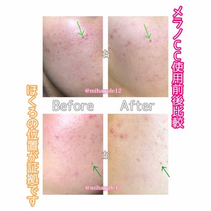 明色美顔水 薬用化粧水/美顔/化粧水を使ったクチコミ(3枚目)
