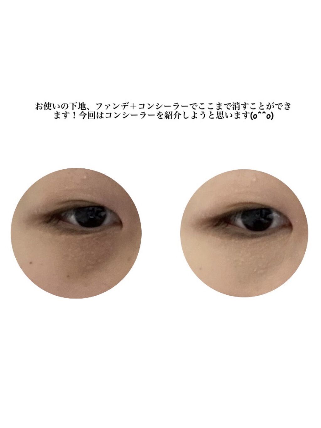 カラーミキシングコンシーラー 02 ナチュラルベージュ/キャンメイク/パレットコンシーラーを使ったクチコミ（3枚目）