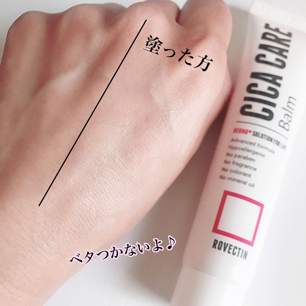 CICAケアバーム/ロベクチン/フェイスクリームを使ったクチコミ(4枚目)