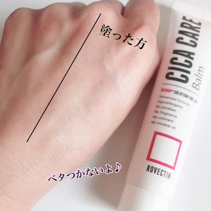 CICAケアバーム/ロベクチン/フェイスクリームを使ったクチコミ(4枚目)