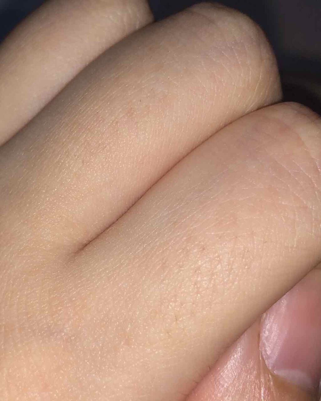 Richesse9 IPL光脱毛器/Richesse9(リシェスナイン)/家庭用脱毛器を使ったクチコミ(3枚目)