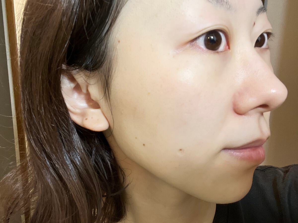 ボタニカル しっとり保湿ローション/ハッピーナチュラル/化粧水を使ったクチコミ(4枚目)