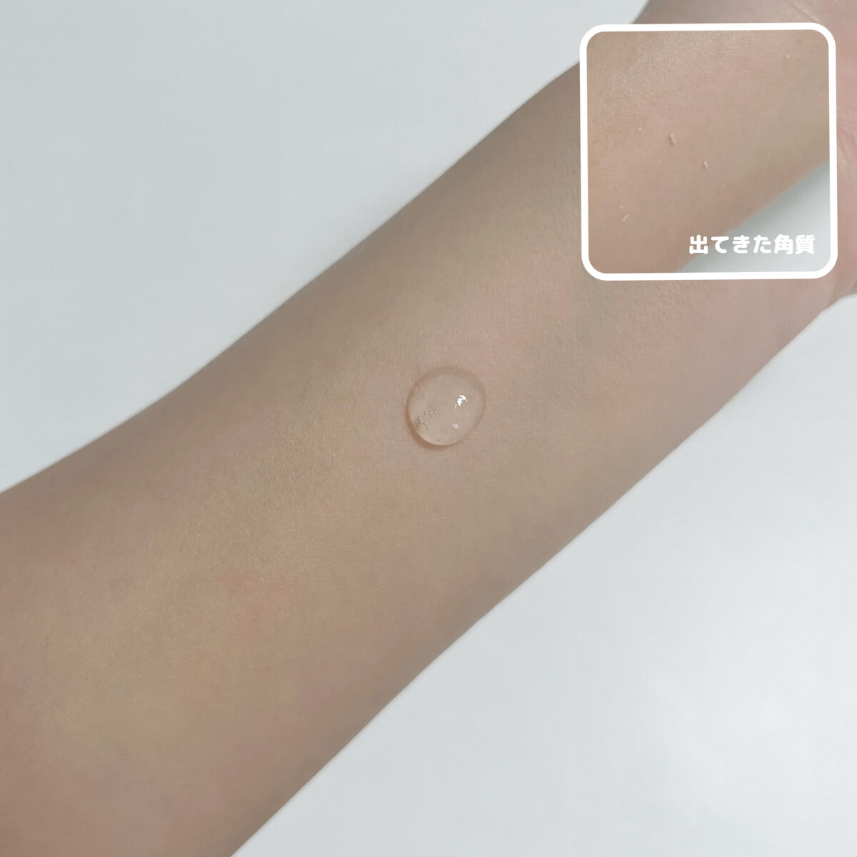 フェイシャルマイルドピーリング/primera/ピーリングを使ったクチコミ（3枚目）