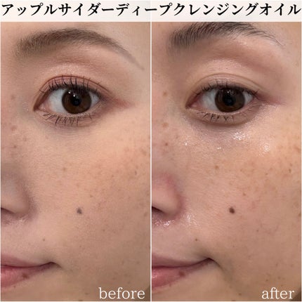 アリウルアップルサイダーディープクレンジングオイル/Ariul/オイルクレンジングを使ったクチコミ(4枚目)