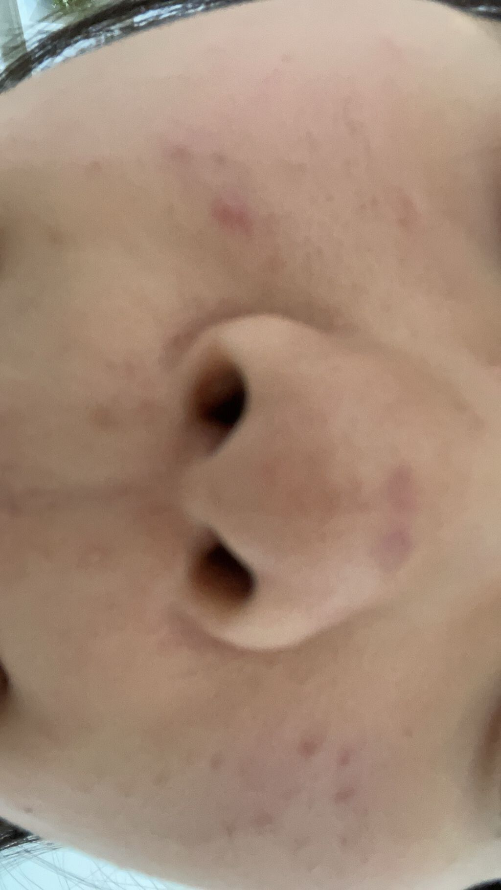 riko_ on LIPS 「汚肌の治し方教えて下さい!美肌になりたいです、、高校1年生女子..」(2枚目)