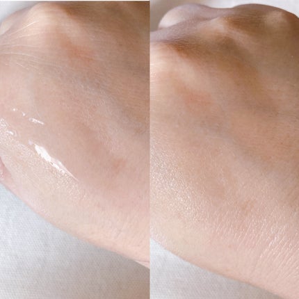 ティーツリーヒアルロン酸オイルフリーアンプル/Vertty/美容液を使ったクチコミ(5枚目)