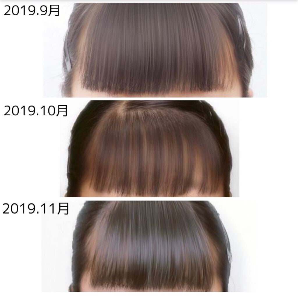 まとめ髪スティック スーパーホールド/マトメージュ/ヘアワックス・クリームを使ったクチコミ(3枚目)